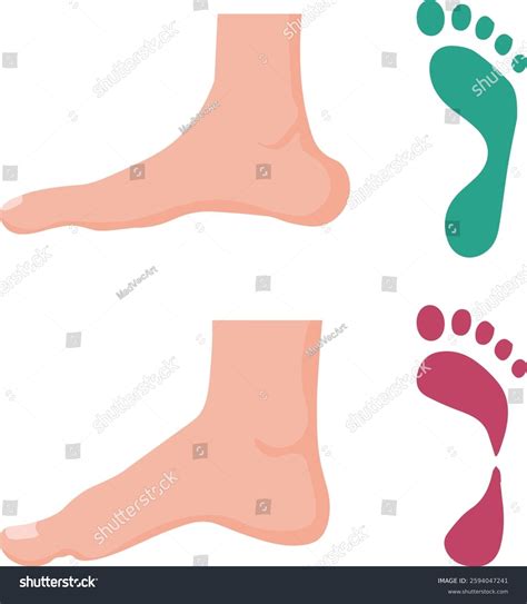 Stages Flat Foot Vector Stock Vector (Royalty Free) 2594047241