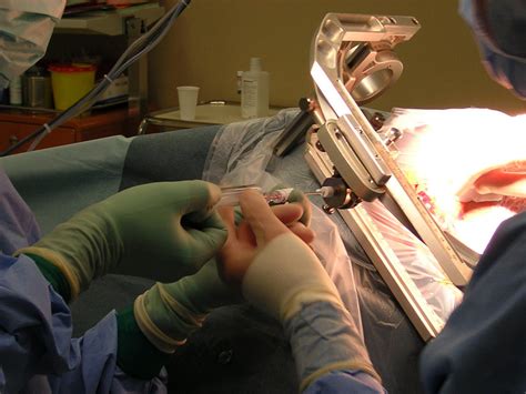 Biopsy | Mesothelioma Help Cancer Organization