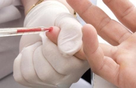 Базофилы повышены у взрослого: о чем это говорит?