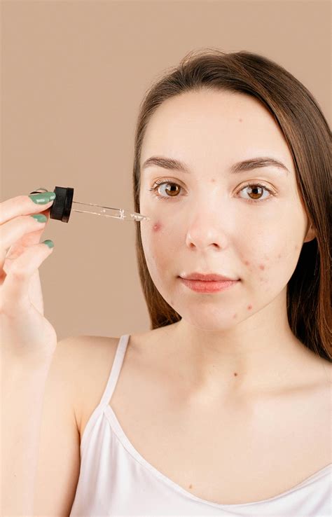 S03E22. Debunking Acne Myths: Why Quick Fixes Don't Work
