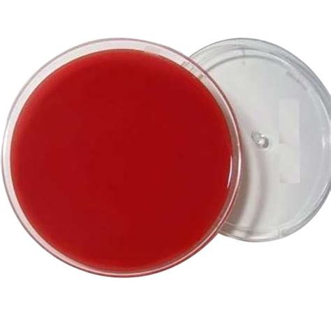 Sheep Columbia Blood Agar Plates Application: Chemical Laboratory at ...