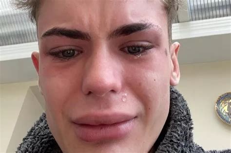 'Turkey teeth left me looking like a shark – I feel like plucking them ...