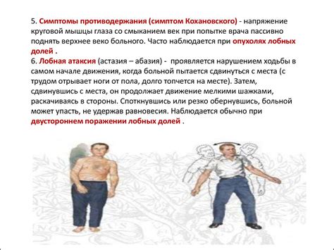 Симптомы поражения лобной доли - презентация онлайн