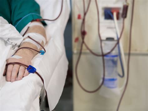 דיאליזה - סקירה • MedNews