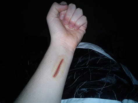 Baylee Adami: Learning To Live With The Leak's Scars