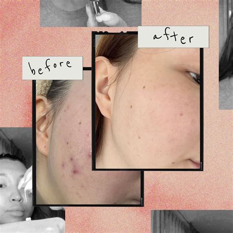 best serums for the face 13