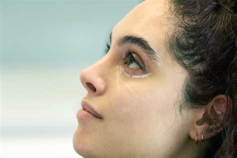 tear trough fillers dd clinical chester