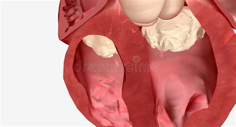 The septum of the heart stock illustration. Illustration of venule ...