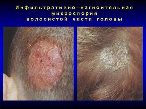 ПО ДАННЫМ ЭКСПЕРТОВ ВОЗ КАЖДЫЙ 5 -ый ЖИТЕЛЬ