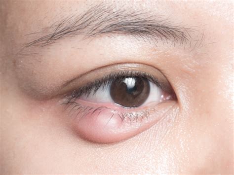 Shree Meenakshi Eye Hospital, conveniently located in Nallakunta ...