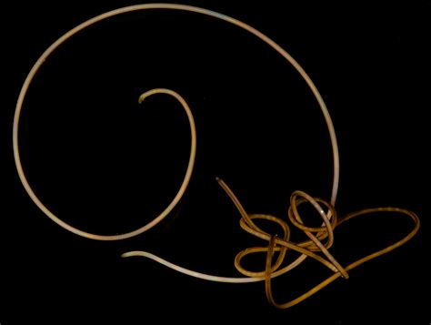 “Mind controlling” parasitic worms are missing genes found in every ...