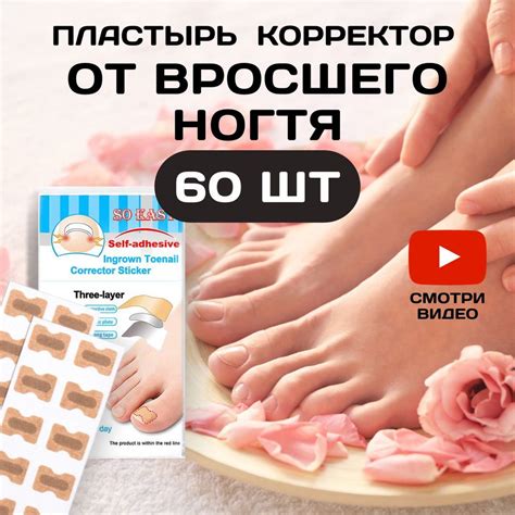 Наклейка пластырь - корректор от вросшего ногтя при врастании ногтевой ...