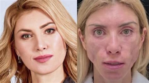Модель из Сочи Юлия Тарасевич, которая теперь не может улыбаться после ...