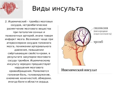 Первая помощь при сердечной недостаточности и инсульте