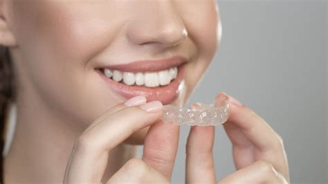 Alinhador Dental Preço