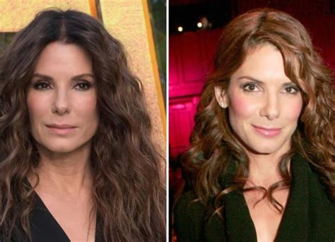 Sandra Bullock Plastic Surgery: Sandra Disagree With The Rumors
