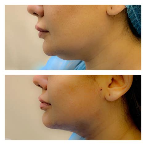 Aesthetic Facial Surgery - Dr. Ahmed Naji MD FACS
