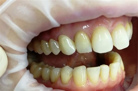 Наши работы — Стоматологическая клиника DENTAL ART