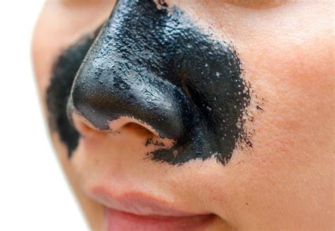 5 Unbelievable Blackhead Removal 2024 Hacks You Need to Try NOW! - 1ha76a6