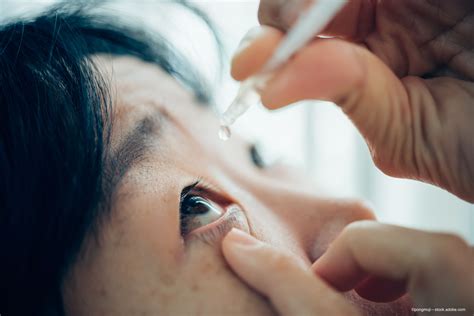 FDA challenges quality requirements for ophthalmic drugs with revised