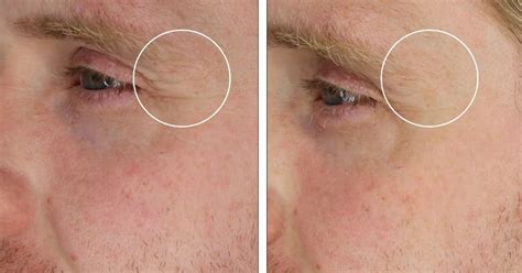 Brand launches new pore perfector that's £10 cheaper than rivals on the ...