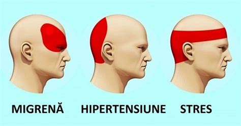 Durerea de cap: cauze, simptome, clasificare și remedii