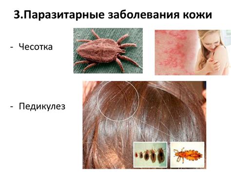 Санитария и гигиена парикмахерских услуг: Кожные заболевания ...