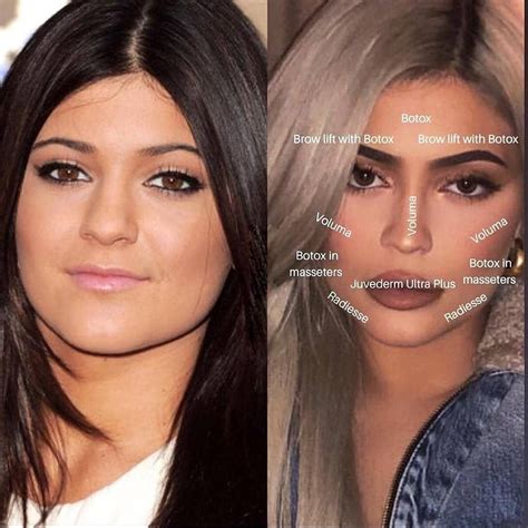 Goals Aesthetics on Instagram: “Well hello there Ms. Jenner, 😘 you’re ...