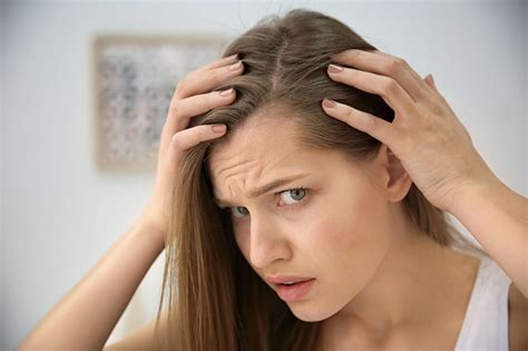 how to deal with balding hair