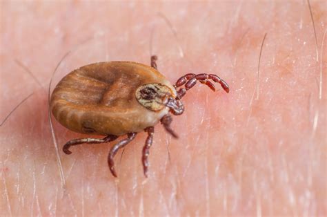 tick bites   avoid         bitten bbc
