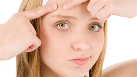 fakta tentang komedo