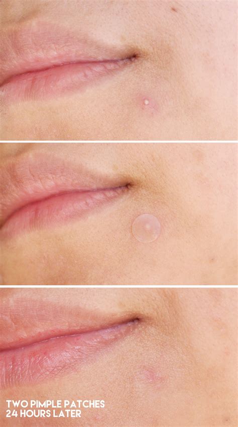 Murrieta Patch: Before & After Photos Will Astound You! Image 6