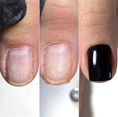 Сложная кутикула: Такие разные: как правильно работать с разными типами ...