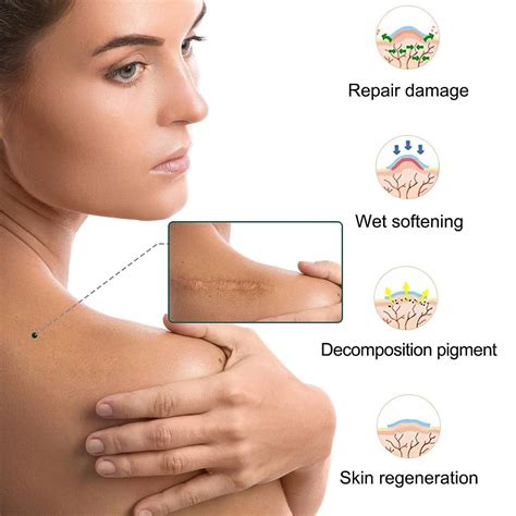 Silicone Scar Patch Roll - Professional Scar Removal Tape for Surgery