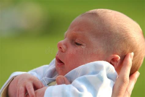 Baby with Allergic Diathesis Stock Image - Image of childhood, facial ...