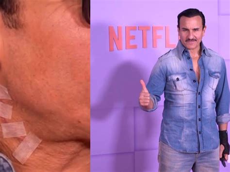 Saif Ali Khan wounds - Latest News, Photos & Videos on Saif Ali Khan ...