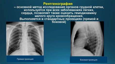 Лучевая диагностика органов дыхания - презентация онлайн