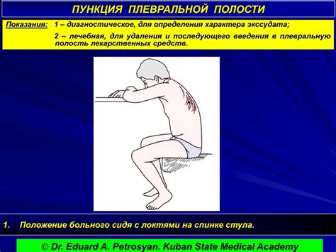Операции на грудной клетке - презентация онлайн