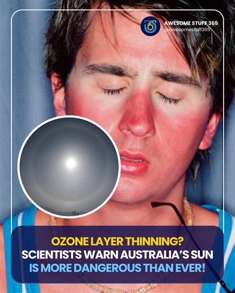 Deciphering Australia's Elevated UV Radiation and Skin Cancer Prevalence