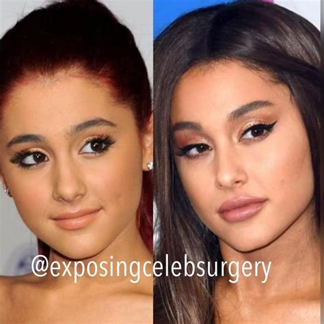 Why celebrities like Bella Hadid, Ariana Grande, and Kylie Jenner are ...