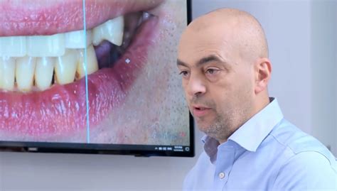 Съвременни методи за заместване на липсващ зъб - beautydental