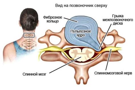 Цигун для шеи, плеч и головы при шейном остеохондрозе - китайская ...