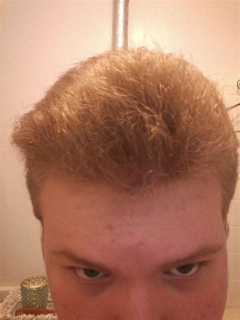 Dry Frizzy Hair Men