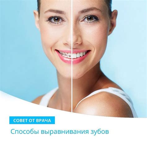 ЛУЧШИЕ СТОМАТОЛОГИ ВЛАДИВОСТОК on Instagram: “Краткая консультация от ...