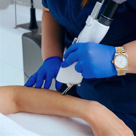 laser hair removal how to
