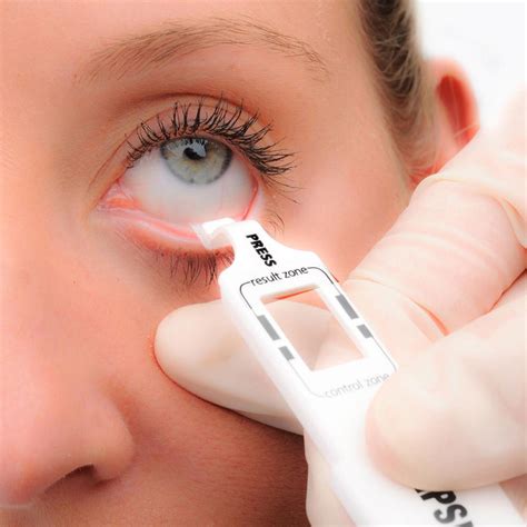 InflammaDry Rapid Testing for Dry Eye