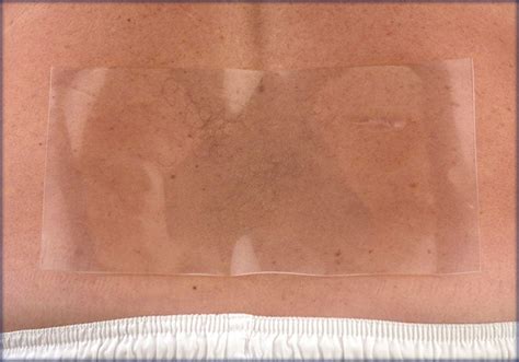Scar FX 4" x 8" Self-Adhesive Silicone Sheeting - DirectDermaCare