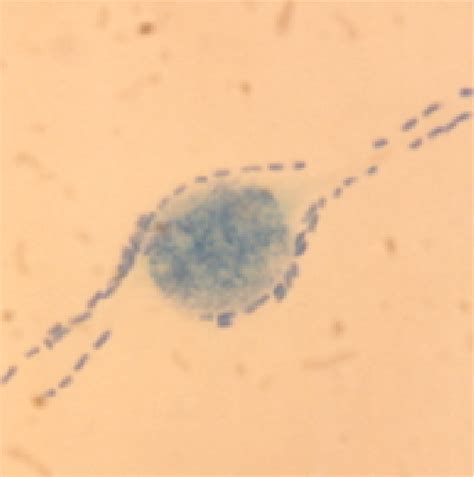 Figure 1 from Studies on Plesiomonas shigelloides isolated from ...
