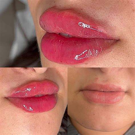 Tired of constant shaving and irritation? At The Beauty Spot – Nurse
