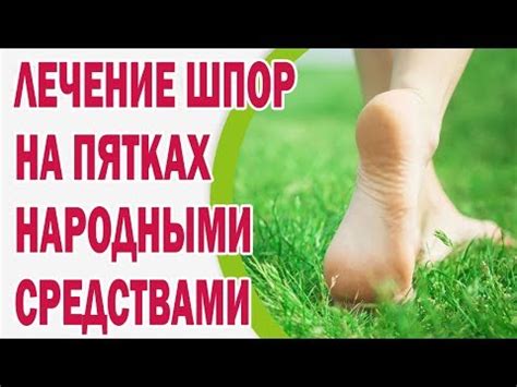 Лечение шпор на пятках народными средствами - YouTube